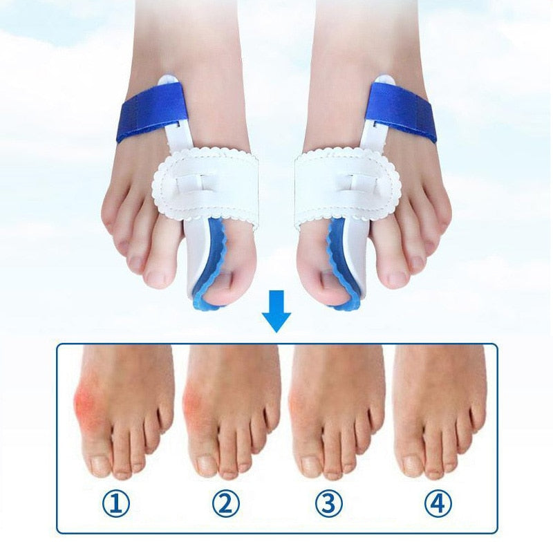 Correcteur Hallux Valgus HarmonyStep Confort Orthopédique