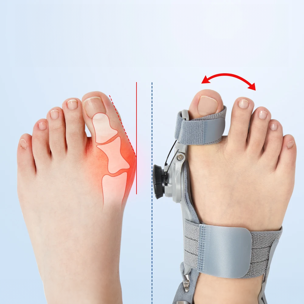 Férula ajustable para hallux valgus