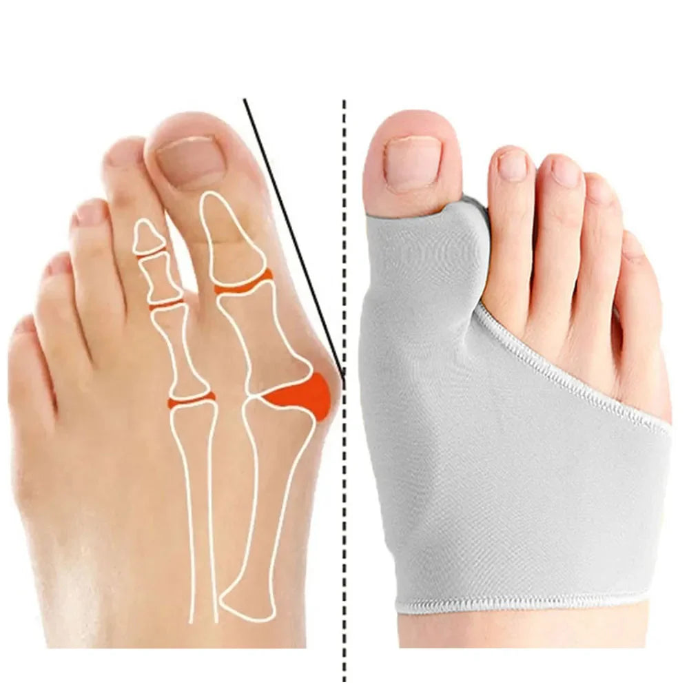 Ortesis de gel hallux valgus