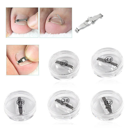 Correcteur d'ongles incarnés en acier inoxydable Confort Orthopédique