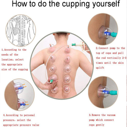 Ensemble de Thérapie CUPPING  Tasses Ventouse chinoises Confort Orthopédique